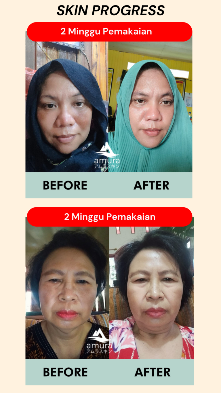 Testimoni-Skin-ProgresAmura-Beauty-Care-12.png