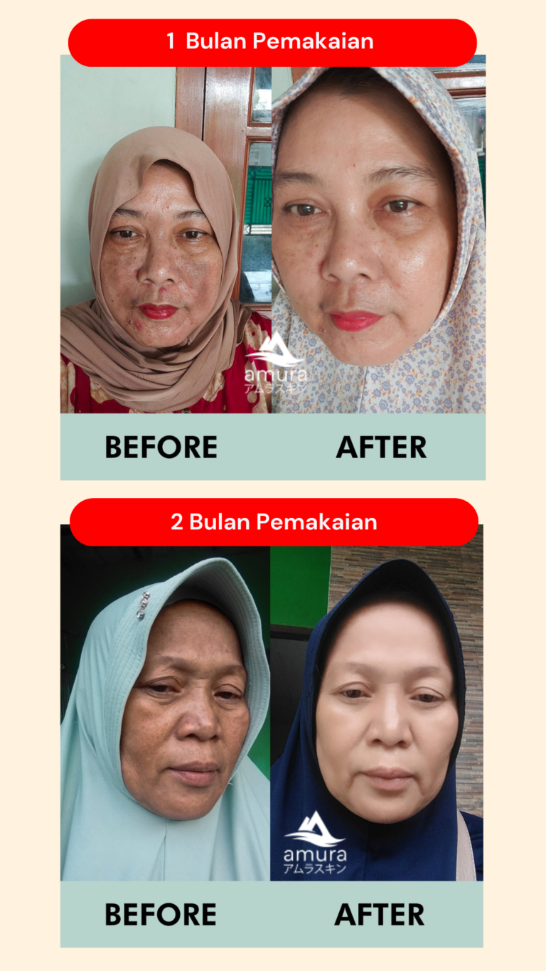 Testimoni-Skin-ProgresAmura-Beauty-Care-13.png