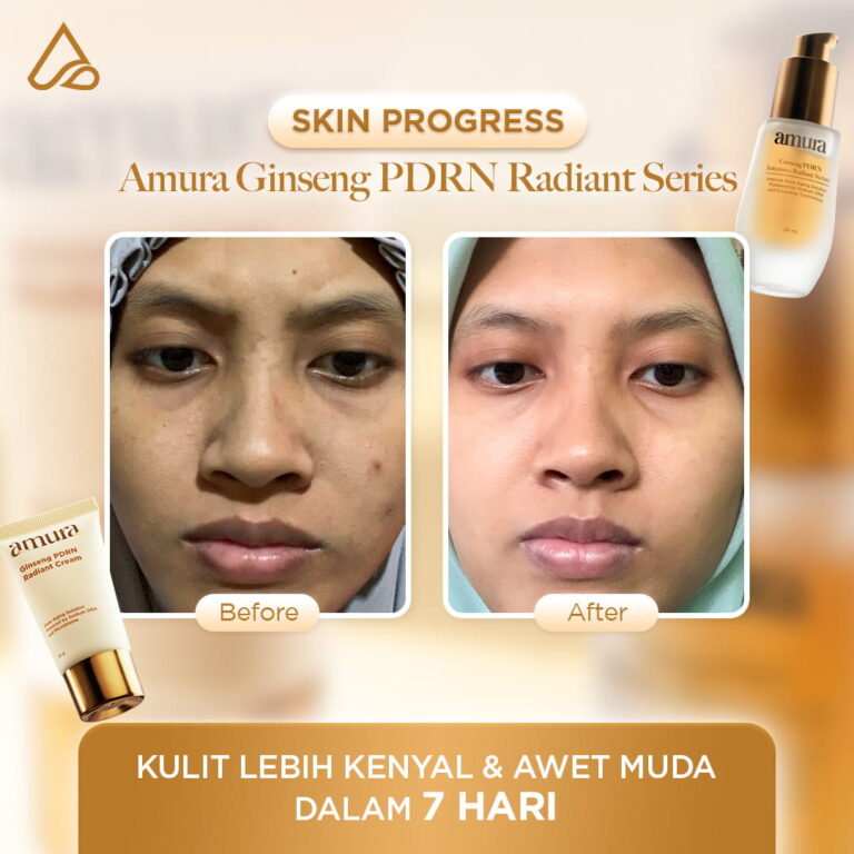 Before after_1