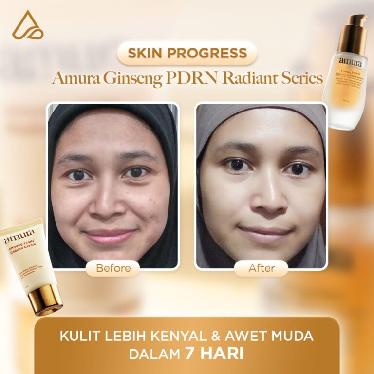 Before after_3
