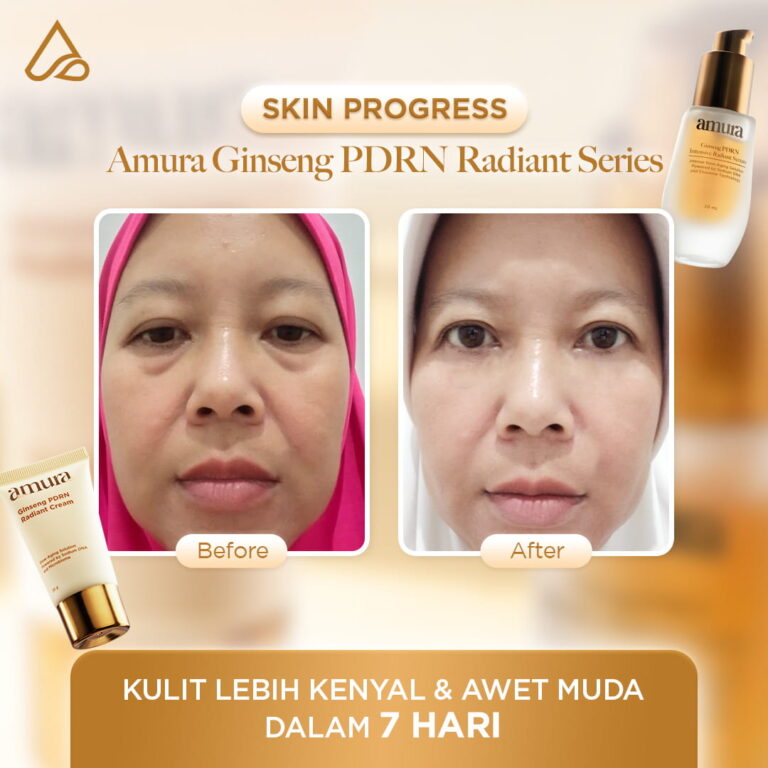 Before after_4
