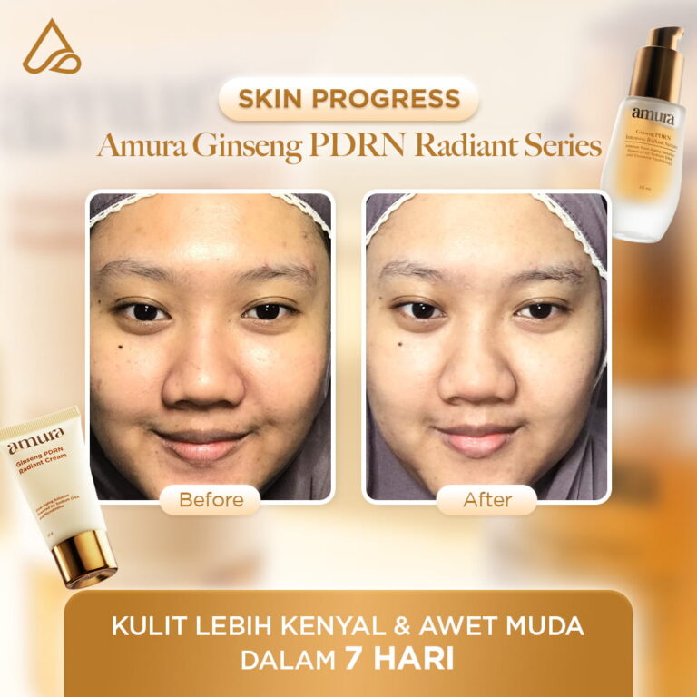Before after_5