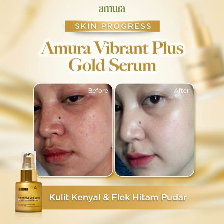Before-After-Gold-3-1-1-1.jpg