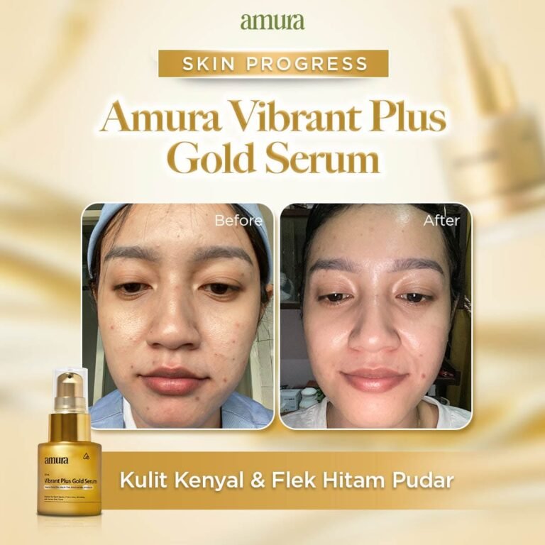 Before-After-Gold-5-1-1.jpg
