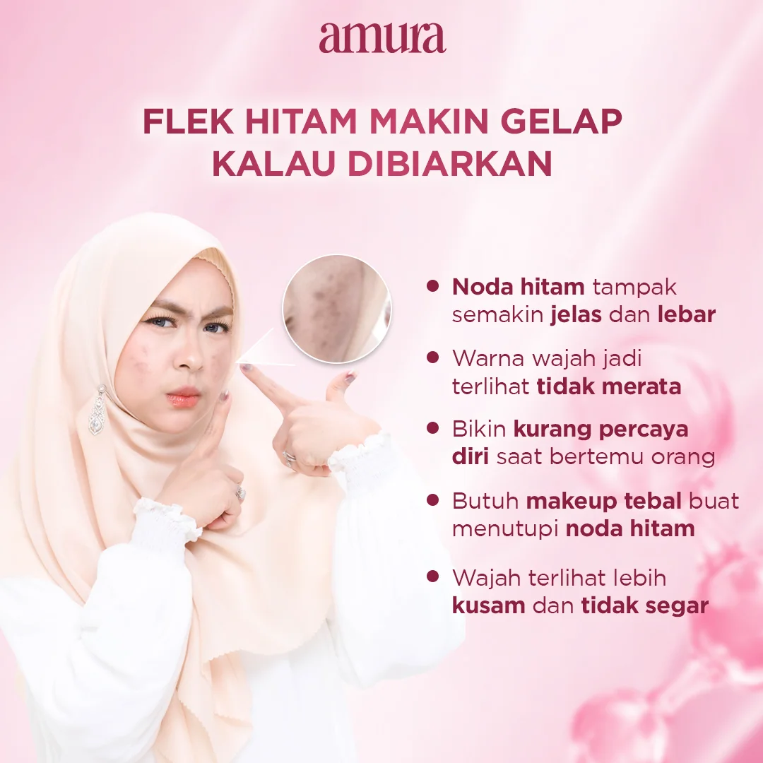 Ilustrasi Flek Hitam Makin Gelap Kalau Dibiarkan untuk Amura Spotless Radiance Dark Spot Treatment solusi Ampuh untuk Flek...