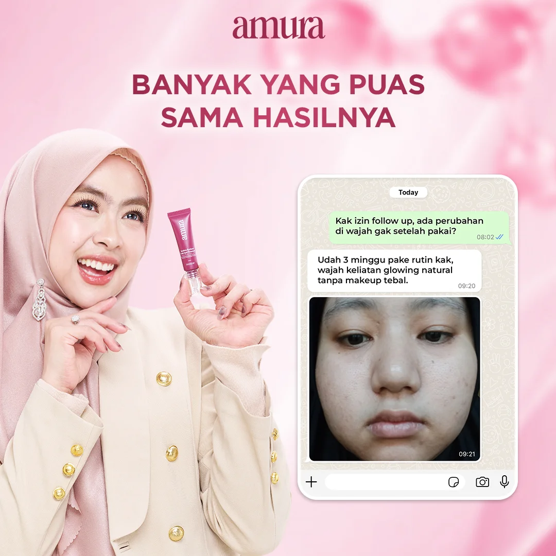 Ilustrasi Banyak Yang Puas Sama Hasilnya untuk Amura Spotless Radiance Dark Spot Treatment solusi Ampuh untuk Flek Hitam &...