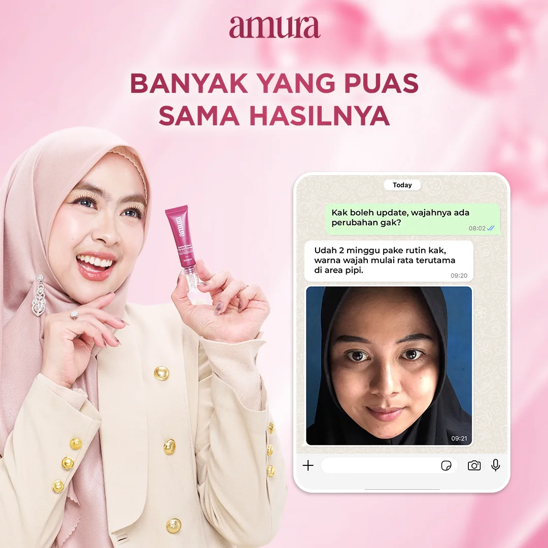 Ilustrasi Banyak Yang Puas Sama Hasilnya untuk Amura Spotless Radiance Dark Spot Treatment solusi Ampuh untuk Flek Hitam &...