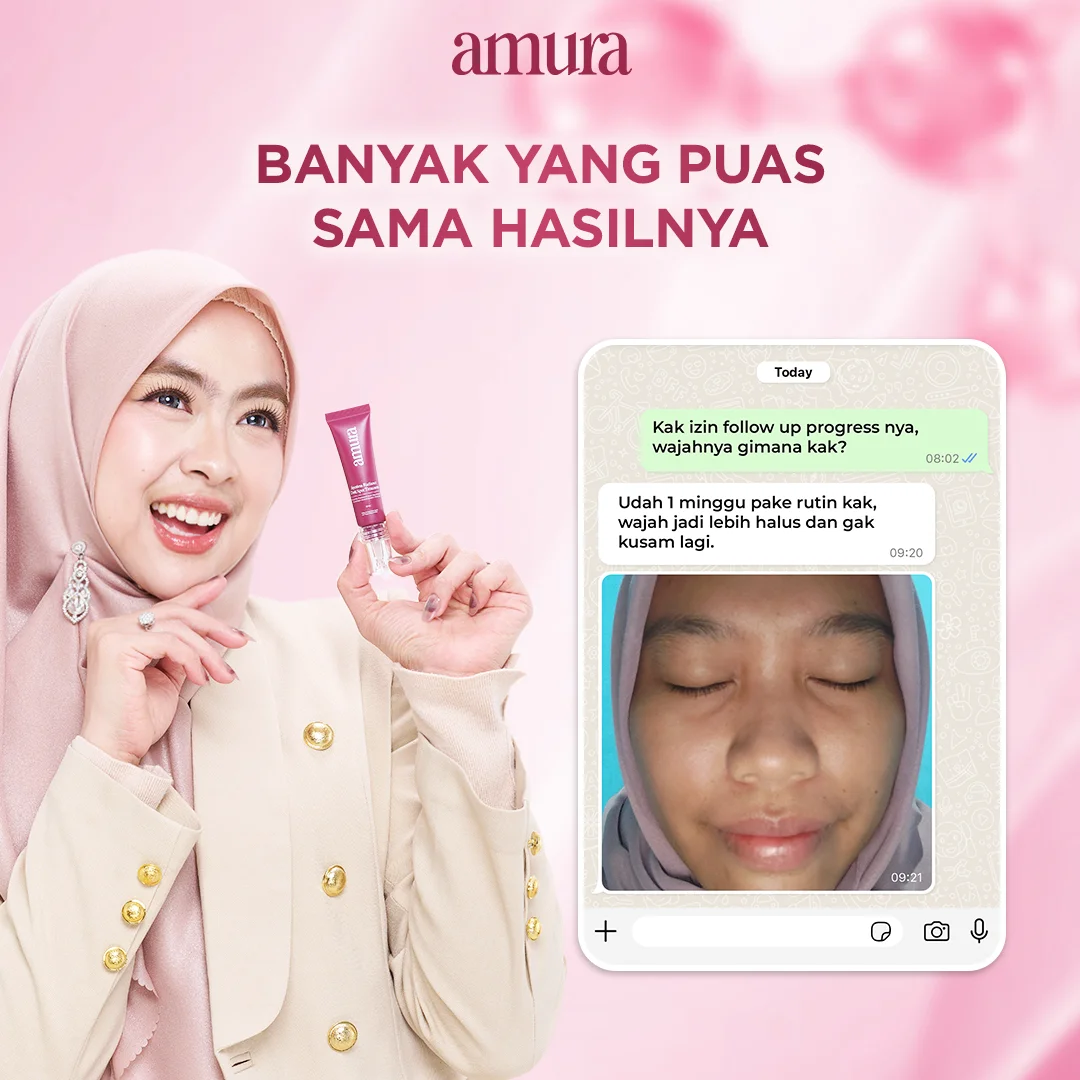 Ilustrasi Banyak Yang Puas Sama Hasilnya untuk Amura Spotless Radiance Dark Spot Treatment solusi Ampuh untuk Flek Hitam &...